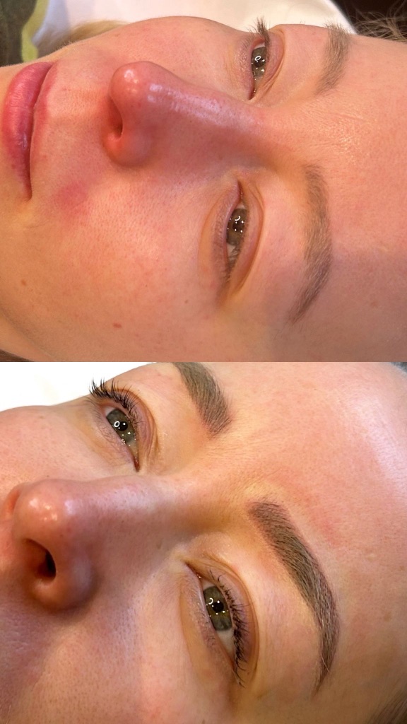 Brows before and after